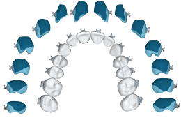 Full Teeth Section